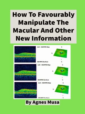 cover image of How to Favourably Manipulate the Macular  and Other New Information